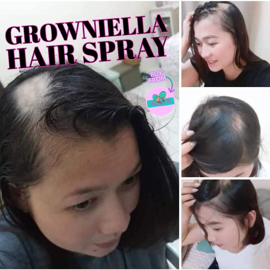 Growniella 3in1 Hairspray Hair Grower