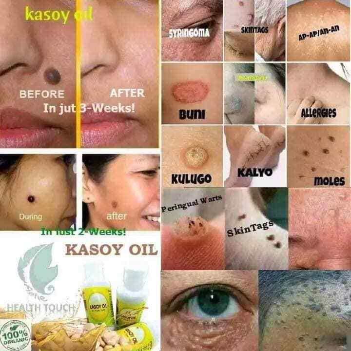 Kasoy Oil by Angel Touch